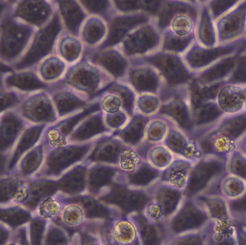 HepG2细胞;人肝癌细胞		