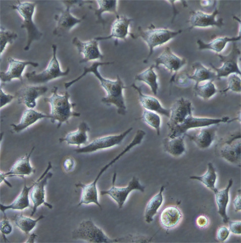 3AO细胞;人卵巢癌细胞