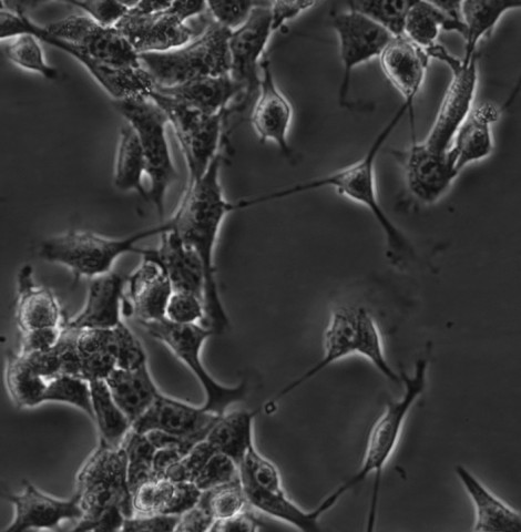 4T1细胞;小鼠乳腺癌细胞
