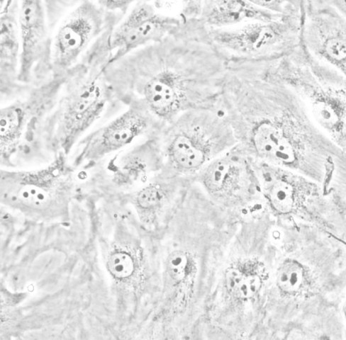 769-P细胞;人肾细胞腺癌细胞
