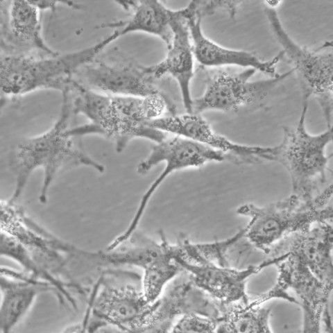 A172细胞;人脑胶质瘤细胞