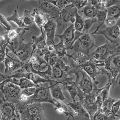 BT-549细胞;人乳腺癌细胞