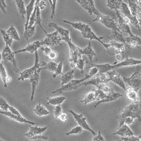 DF-1细胞; 鸡胚成纤维细胞