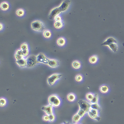 DU145细胞;人前列腺癌细胞