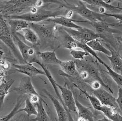 HASMC细胞;人主动脉平滑肌细胞