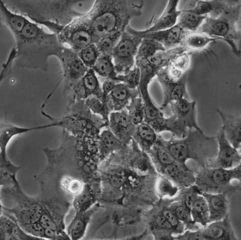 HCC827细胞;人非小细胞肺癌细胞