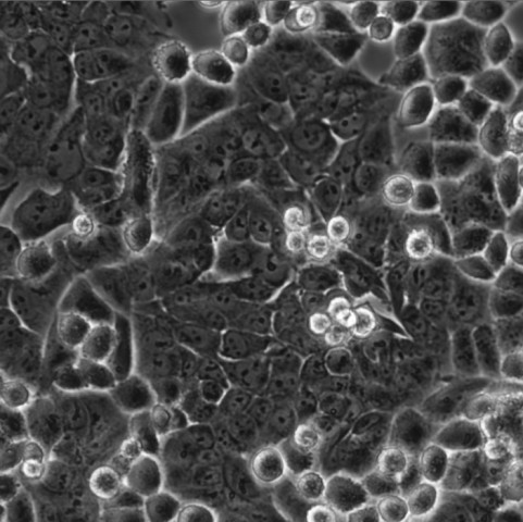 HCT-8细胞;人回盲肠癌细胞