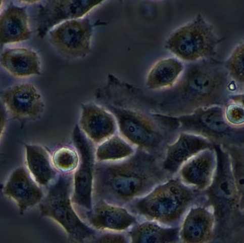 bel-7404细胞;人肝癌细胞