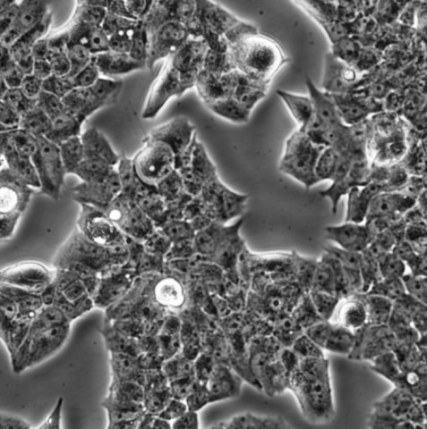 MDA-MB-361细胞;人乳腺癌细胞