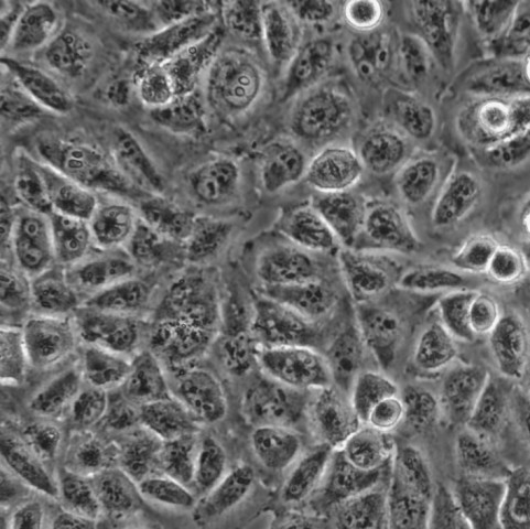 MGC-803细胞;人胃癌细胞