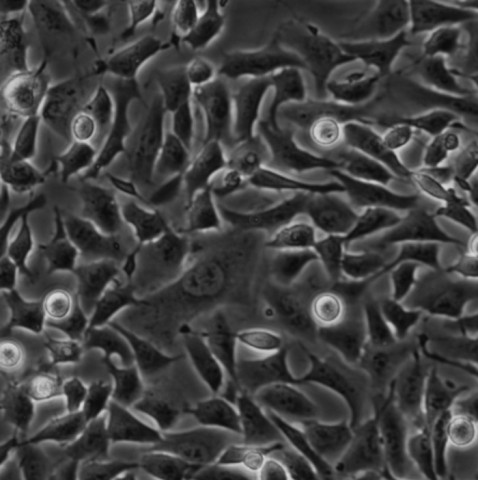 RLE-6TN细胞;大鼠肺上皮Ⅱ型细胞