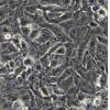 786-O细胞;人肾透明细胞腺癌细胞