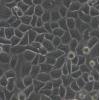 A2780-DDP细胞;人卵巢癌细胞顺铂耐药株