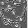 Bel-7405细胞;人肝癌细胞