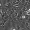 Caski细胞;人宫颈癌细胞