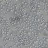 HO-8910PM细胞;高转移人卵巢癌细胞