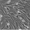 HASMC细胞;人主动脉平滑肌细胞