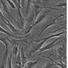 HC-OA细胞;成人软骨细胞-骨性关节炎		