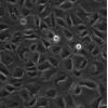 MFC细胞;小鼠前胃癌细胞