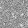 NCI-H3255细胞;人肺癌细胞