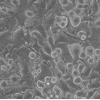 NOZ细胞;人胆囊癌细胞