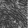 HKF细胞;人瘢痕疙瘩成纤维细胞