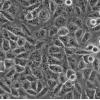 MGC-803细胞;人胃癌细胞