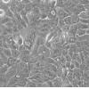HTEPT-RPE1细胞;人永生化视网膜色素上皮细胞系