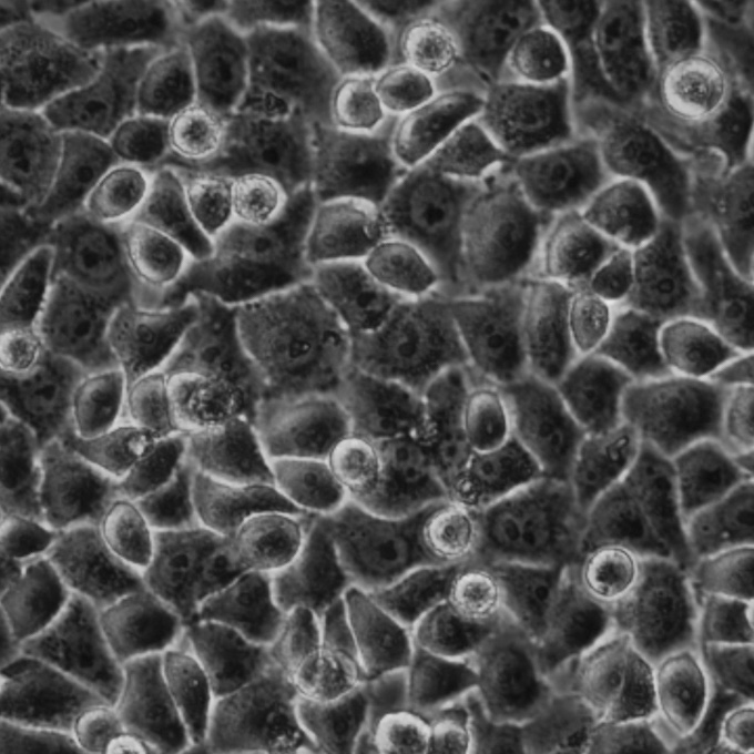 Hela细胞;人子宫颈癌细胞