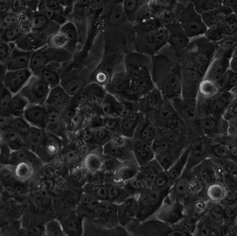 TU212细胞;人喉癌细胞