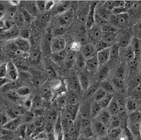 VERO细胞;非洲绿猴肾细胞