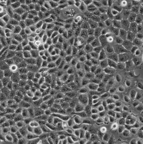 WM3211细胞;人黑色素瘤细胞株