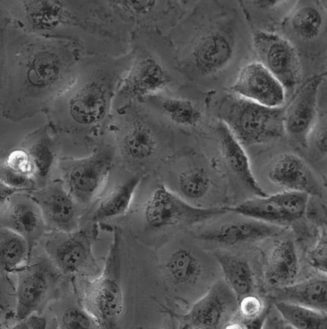 UM-UC-3细胞;人膀胱移行细胞癌