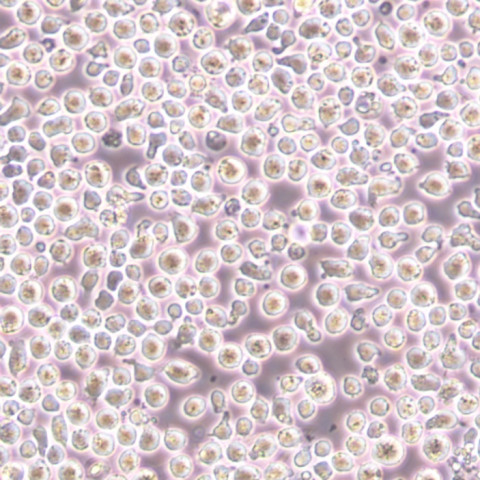 SNK6细胞;人NK/T细胞淋巴瘤细胞