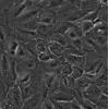 SNB-19细胞;人胶质瘤细胞