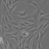 SW982细胞;人滑膜肉瘤细胞
