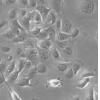 TE-5细胞;人食管癌细胞 