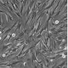T/G HA-VSMC细胞;人血管主动脉平滑肌细胞
