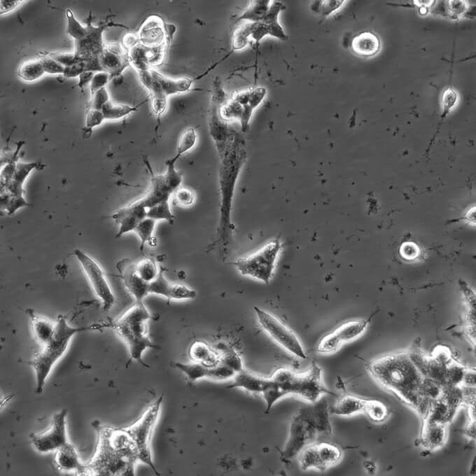 22RV1细胞;人前列腺癌细胞