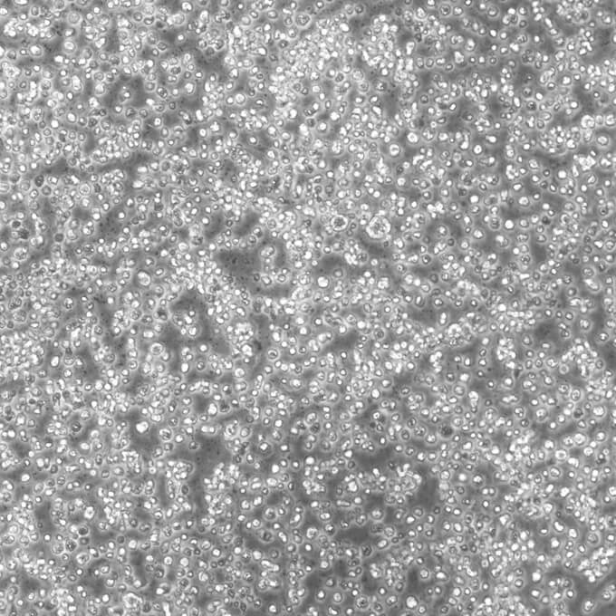 MM1.S细胞;人免疫球蛋白λ型骨髓瘤