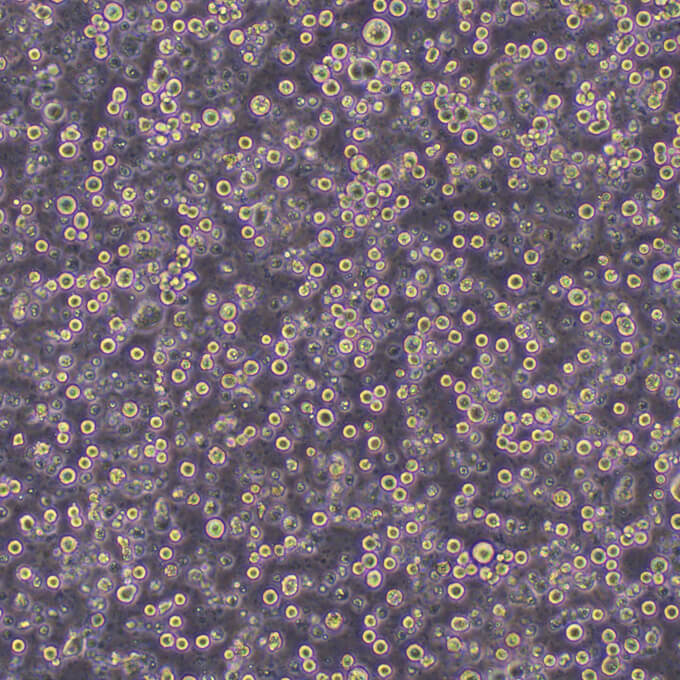 SK-BR-3细胞;人乳腺癌细胞