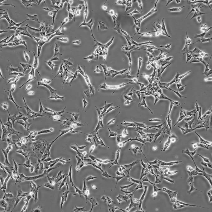 SV40-MES-13细胞;小鼠肾小球系膜细胞