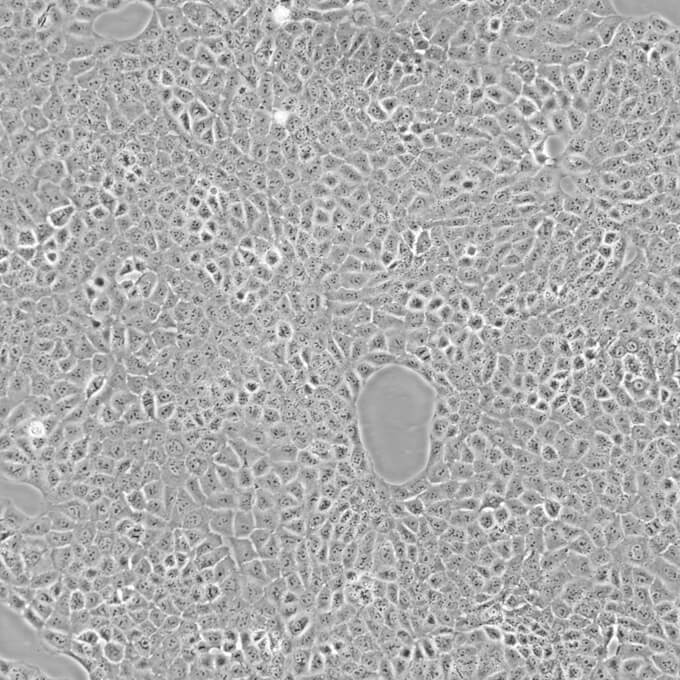 TC-1细胞;小鼠肺上皮细胞