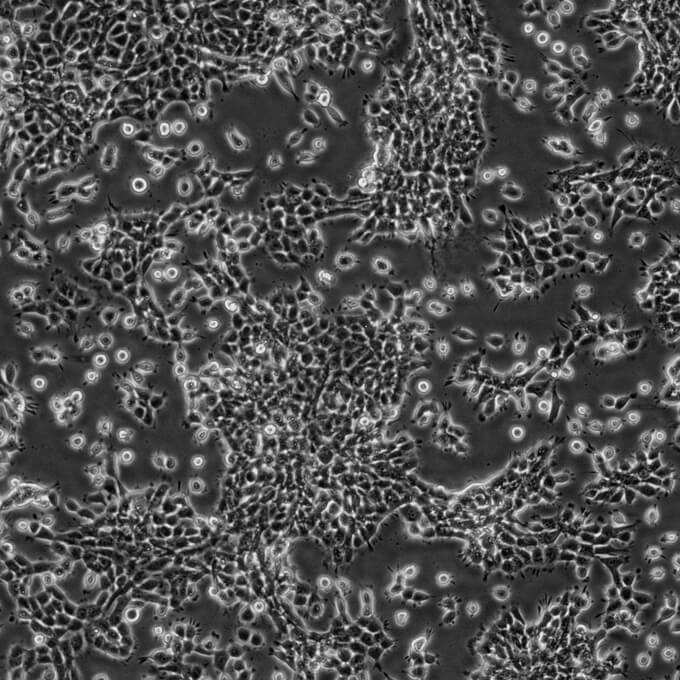 TM3细胞;小鼠睾丸间质细胞