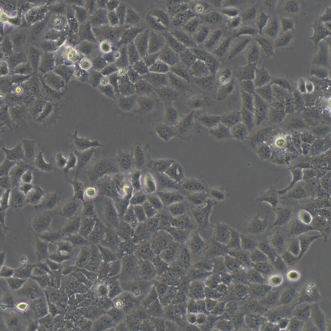 Tu686细胞;人喉癌细胞