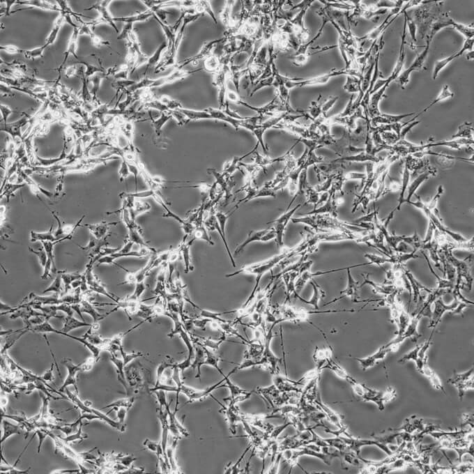 U87MG细胞;人恶性胶质母细胞瘤细胞