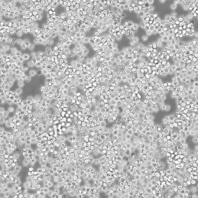 RamosRA.1细胞;人B淋巴细胞瘤细胞