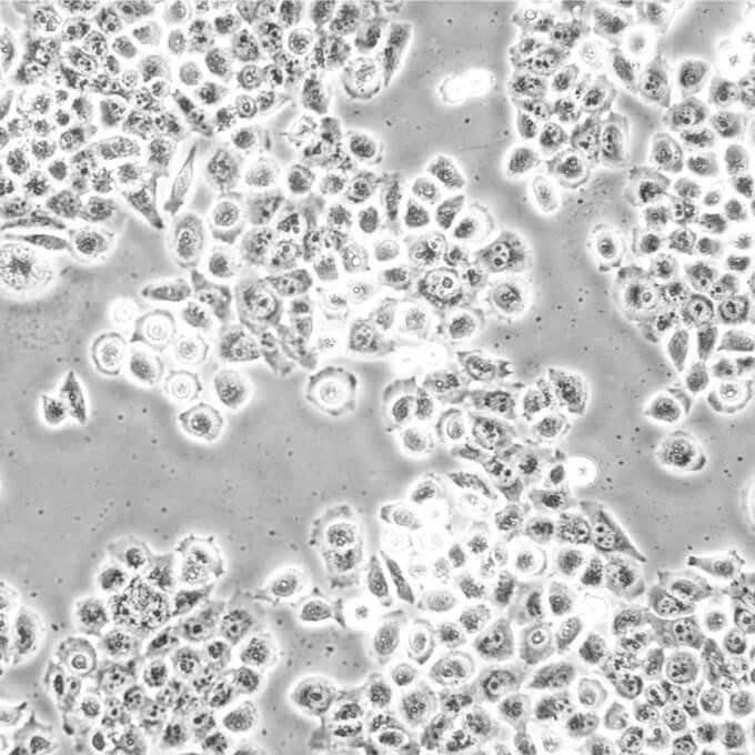 MKN45细胞;人胃癌细胞