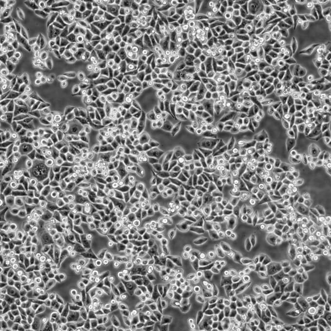 SW1116细胞;人结肠腺癌细胞