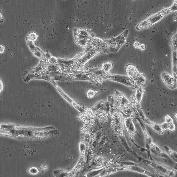 MLTC-1细胞;小鼠睾丸间质细胞瘤细胞
